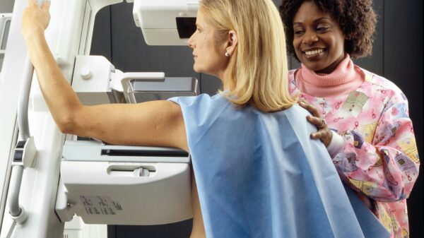 AI helps NHS cut lung cancer scan review times in half
