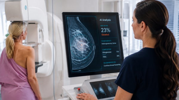 AI spots breast cancer risk years before diagnosis using routine mammograms