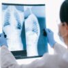 FDA awards breakthrough device designation to Aidoc's AI X-ray tech