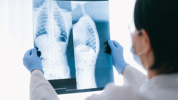 FDA awards breakthrough device designation to Aidoc's AI X-ray tech