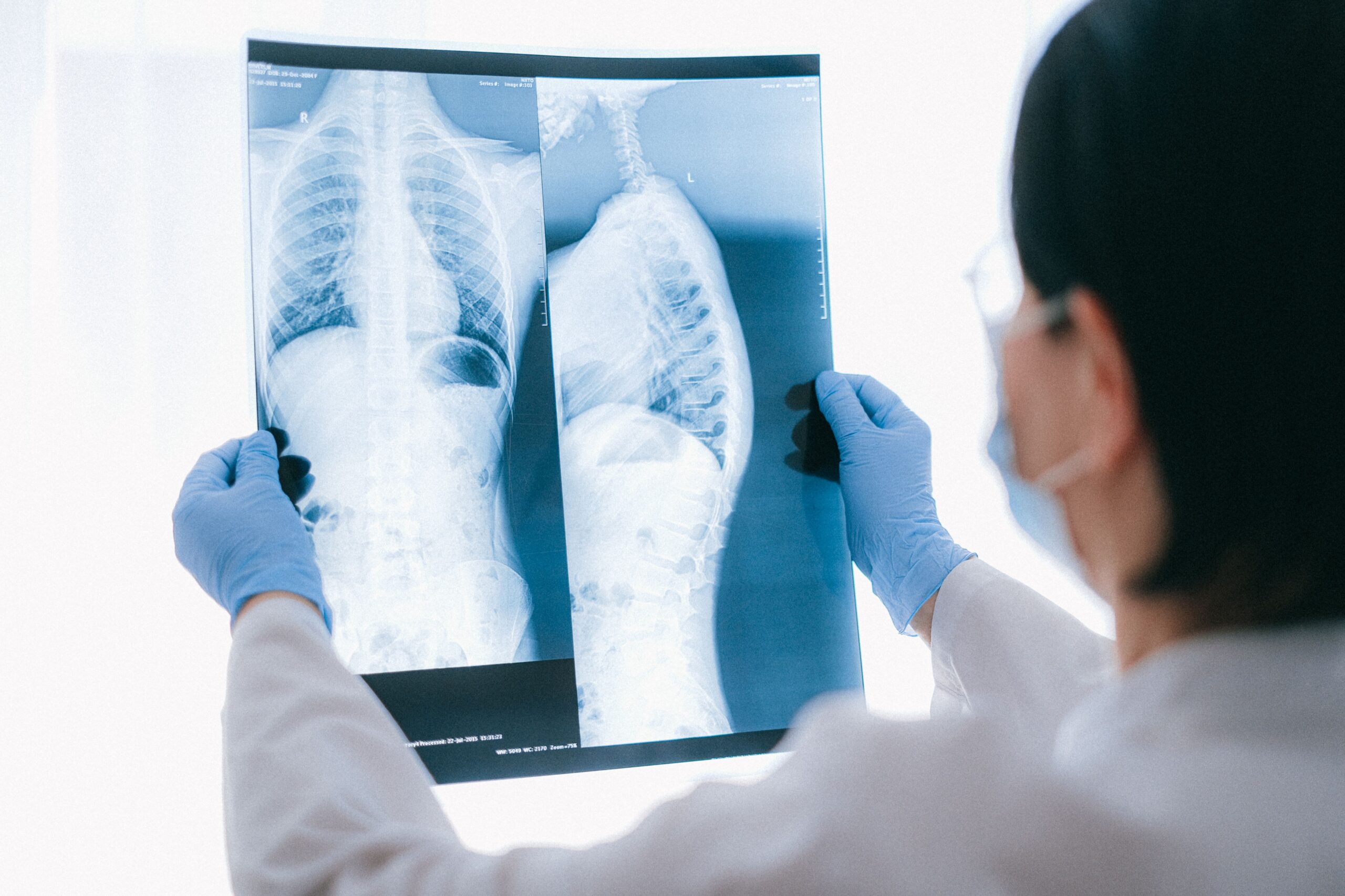 FDA awards breakthrough device designation to Aidoc's AI X-ray tech