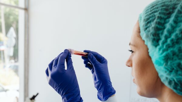Cizzle Biotech rises 16% from Texas launch of lung cancer blood test