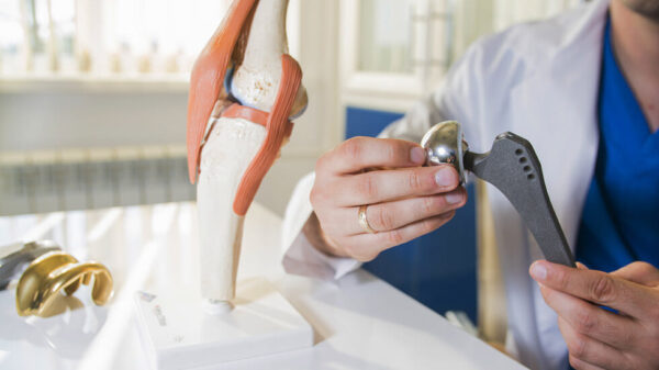 Wellness tech companies WHOOP and Kinomatic try to improve joint replacement recovery
