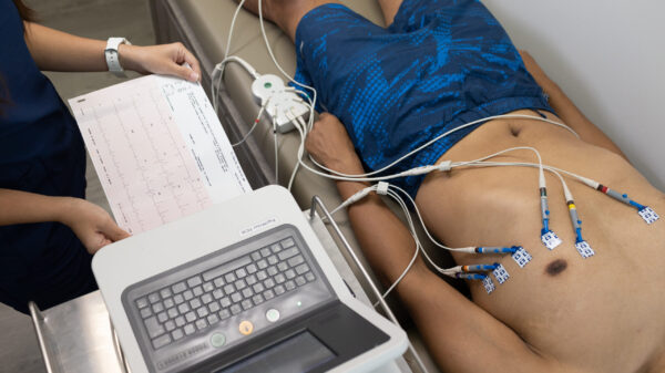 Medtech breakthrough: AI flags heart disease from routine ECG test in seconds