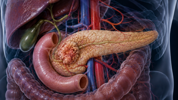 Propanc Biopharma skyrockets from pancreatic cancer drug breakthrough
