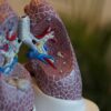 University of Louisville gifted US$4.5M for lung health studies