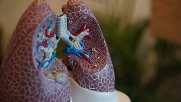 University of Louisville gifted US$4.5M for lung health studies